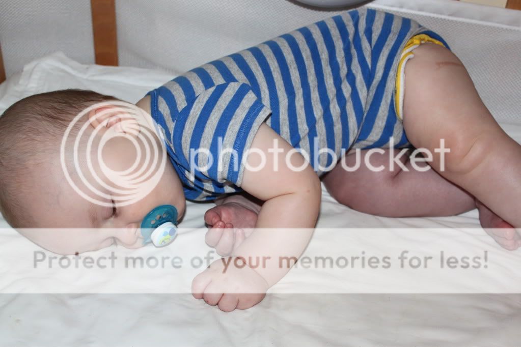 Baby's leg turned purple in his sleep result = just one of those